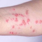 Boston Ties Mpox Vaccine Drive to Pride Month Opening Boston residents encouraged to get mpox vaccine amid uptick in cases